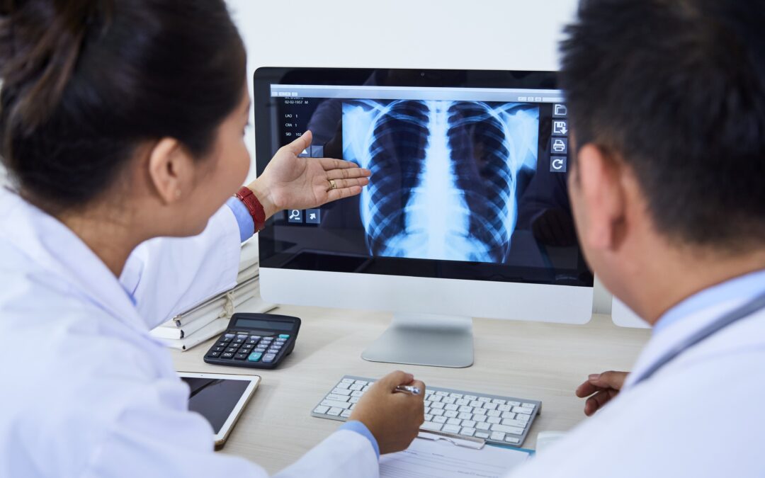 Pulmonary Sarcoidosis – Symptoms, Treatment, and Prognosis